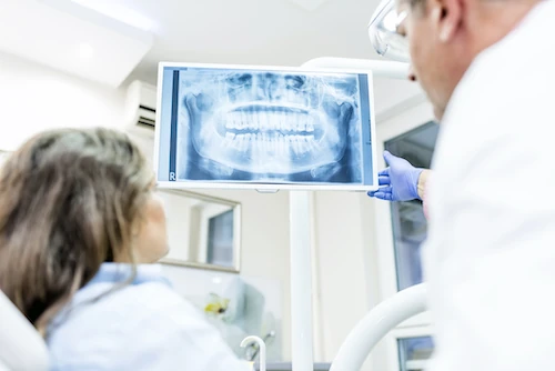 Digital x-rays offered at keith + associates dentistry in Mission, KS.