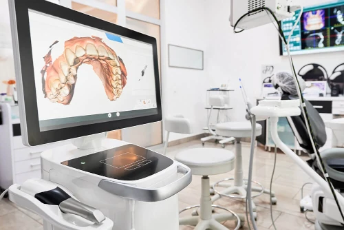 CEREC scanner dental technology at keith + associates dentistry in Mission, KS.