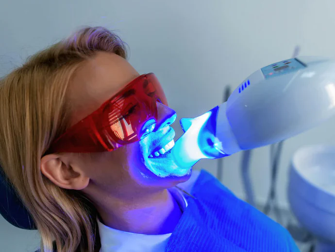Teeth whitening in Mission, KS at keith + associates dentistry.